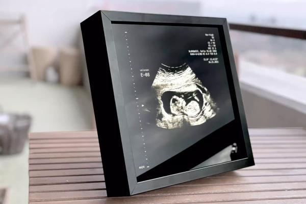 un tableau bleu décoratif sur mesure pour grocesse avec feuille d'or