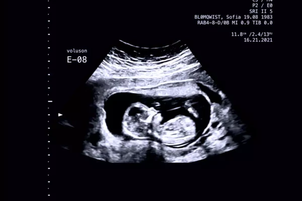 un tableau décoratif sur mesure pour grocesse avec feuille d'or